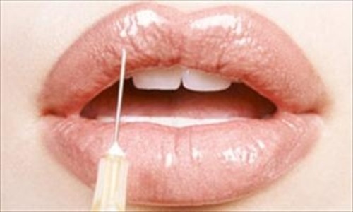 Aumentar el volumen de los labios