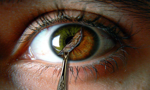 Cirugía ocular: lentes de contacto implantables